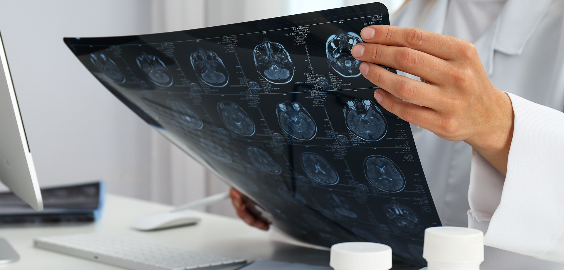a-young-female-doctor-is-looking-at-an-mri-image
